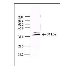 RCK社 SARS CoV 3CL Protease #200-401-A51